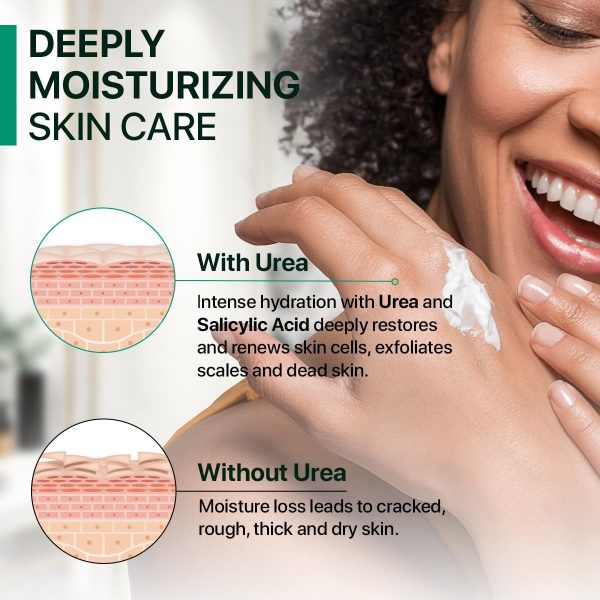 Urea Cream 40 Percent for Feet, 40% Urea Foot Cream for Dry Cracked Heels Knees Elbows Callus Hands Repair Treatment with 2% Salicylic Acid, Foot Moisturizer, Dead Skin Remover, Softener for Feet Care - Image 9